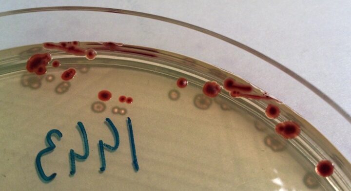 Microbiology - Campylobacter Jejuni